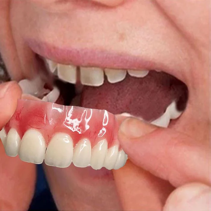 (COMPRE 1 LEVE 2) Dentadura de Silicone FIX | Ajustavel e Adaptativa + Kit de Limpeza de BRINDE - Image 2